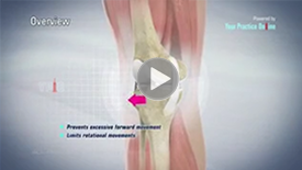 ACL Reconstruction