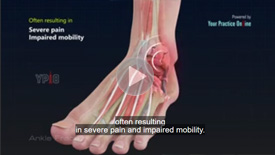 Ankle Injury