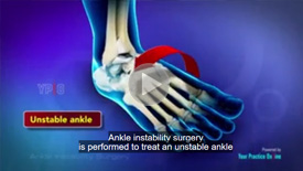 Ankle Instability