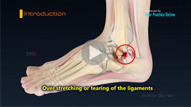 Ankle Sprain