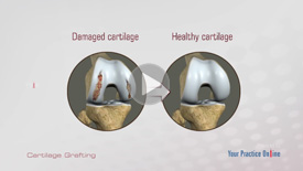 Cartilage Repair and Transplantation