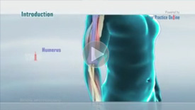 Osteochondritis Dissecans