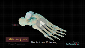 Foot Fracture