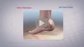 Heel Pain