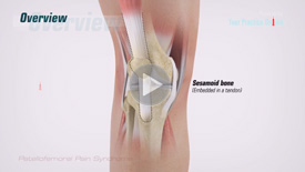 Anterior Knee Pain