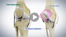 Patellofemoral Instability