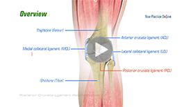 PCL Injuries