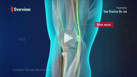 Ulnar Nerve Entrapment